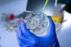 Cultured Microbes in Petri Dish